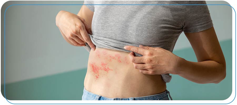 Postherpetic Neuralgia Treatment Specialist Near Me in Wilkes-Barre, PA Postherpetic Neuralgia Treatment Specialist Near Me in Wilkes-Barre, PA