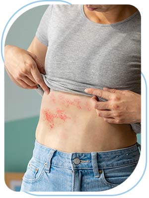Postherpetic Neuralgia Treatment Near Me in Wilkes-Barre, PA