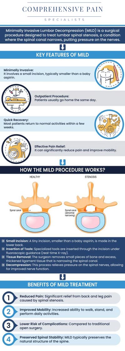 Common questions asked by patients: What is done during the mild procedure? Is the mild procedure worth it? Who is a candidate for the mild procedure? How many years does a mild procedure last? For more information, contact us or book an appointment online. We are located at 1177 PA-315, Dolphin Plaza, Wilkes-Barre, PA 18702. We serve patients from Wilkes-Barre PA, Glen Lyon PA, Dallas PA, Pittston PA, Mountain Top PA, Plymouth PA, and surrounding areas. Common questions asked by patients: What is done during the mild procedure? Is the mild procedure worth it? Who is a candidate for the mild procedure? How many years does a mild procedure last? For more information, contact us or book an appointment online. We are located at 1177 PA-315, Dolphin Plaza, Wilkes-Barre, PA 18702. We serve patients from Wilkes-Barre PA, Glen Lyon PA, Dallas PA, Pittston PA, Mountain Top PA, Plymouth PA, and surrounding areas.